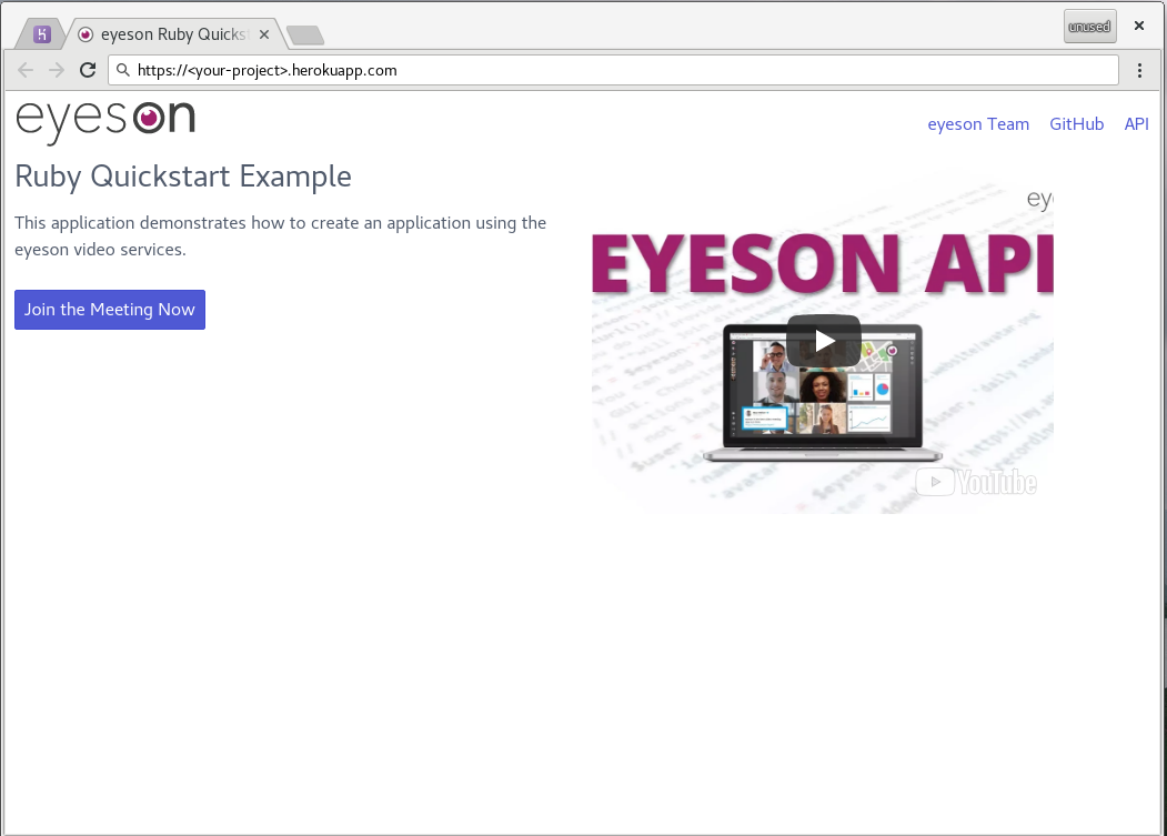 preview of the Eyeson ruby quickstart website